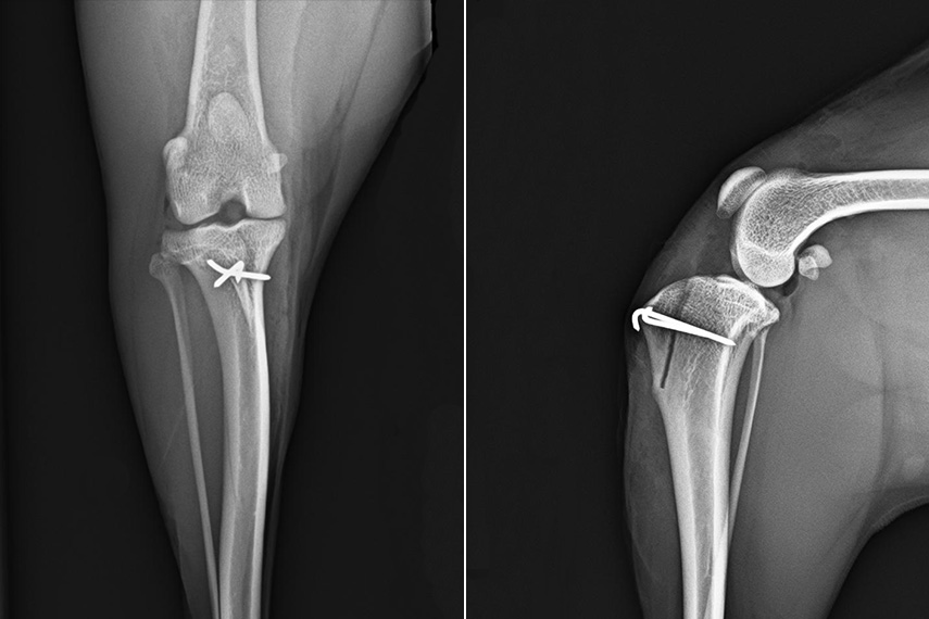 Patellaluxation_post operativ