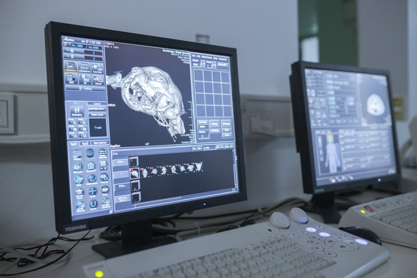 Computertomographie vom Schädel